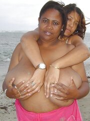 All congenital (beach showing