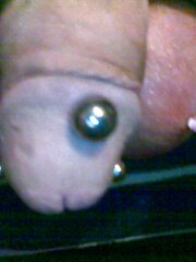 Nutsack medical play