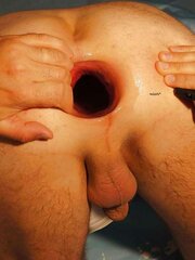 My fake Gape