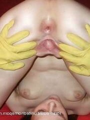 aufgespaltene lippen